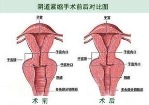 用15年的科学去研究一个名器 | NPG名器的品格 视频测评(图12)